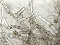 Cladosporium,500x