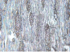 Ulmus minor tg, 100x